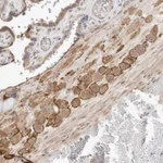 Atlas Antibodies Anti-C8orf86 Antibody