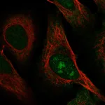 Atlas Antibodies Anti-C8orf59 Antibody