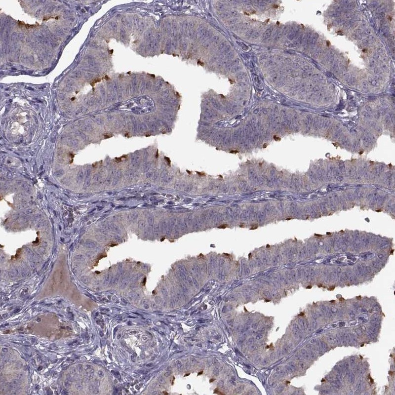 Atlas Antibodies Anti-C9orf116 Antibody