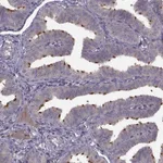 Atlas Antibodies Anti-C9orf116 Antibody