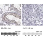 Atlas Antibodies Anti-C8orf88 Antibody