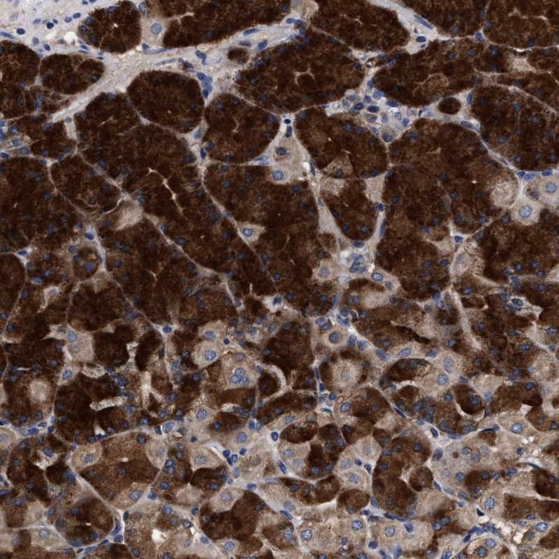 Atlas Antibodies Anti-C9orf135 Antibody
