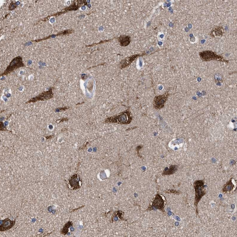 Atlas Antibodies Anti-C9orf135 Antibody