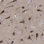 Atlas Antibodies Anti-C9orf135 Antibody