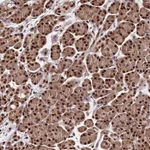 Atlas Antibodies Anti-C9orf142 Antibody