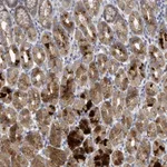 Atlas Antibodies Anti-C9orf152 Antibody