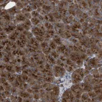 Atlas Antibodies Anti-C9orf16 Antibody