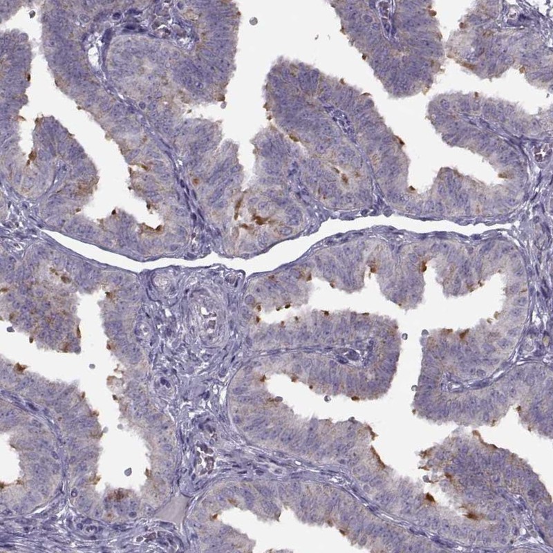 Atlas Antibodies Anti-C9orf116 Antibody