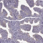 Atlas Antibodies Anti-C9orf116 Antibody