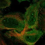 Atlas Antibodies Anti-C9orf153 Antibody