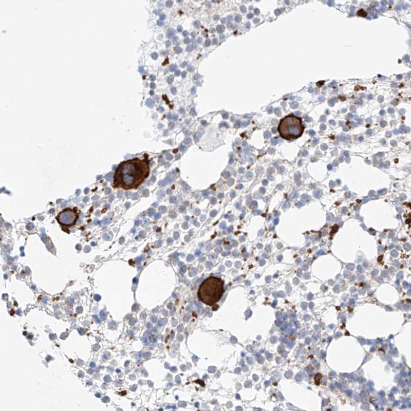 Atlas Antibodies Anti-C9orf172 Antibody