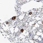 Atlas Antibodies Anti-C9orf172 Antibody