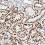 Atlas Antibodies Anti-C9orf3 Antibody
