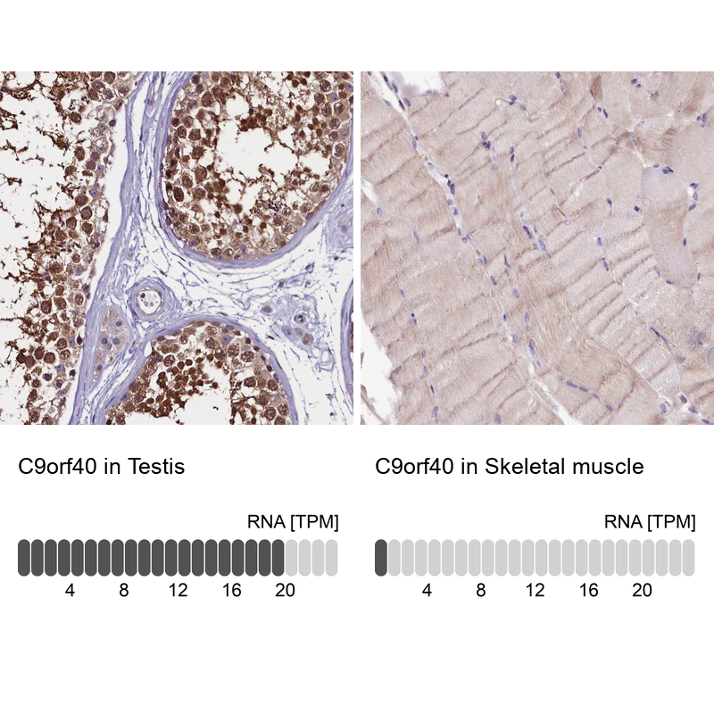 Atlas Antibodies Anti-C9orf40 Antibody