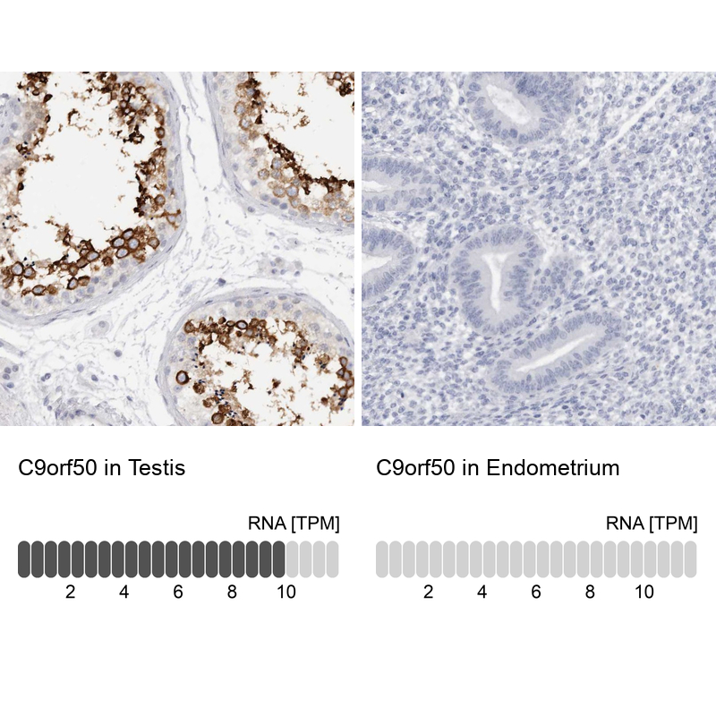 Atlas Antibodies Anti-C9orf50 Antibody