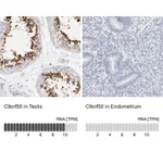 Atlas Antibodies Anti-C9orf50 Antibody
