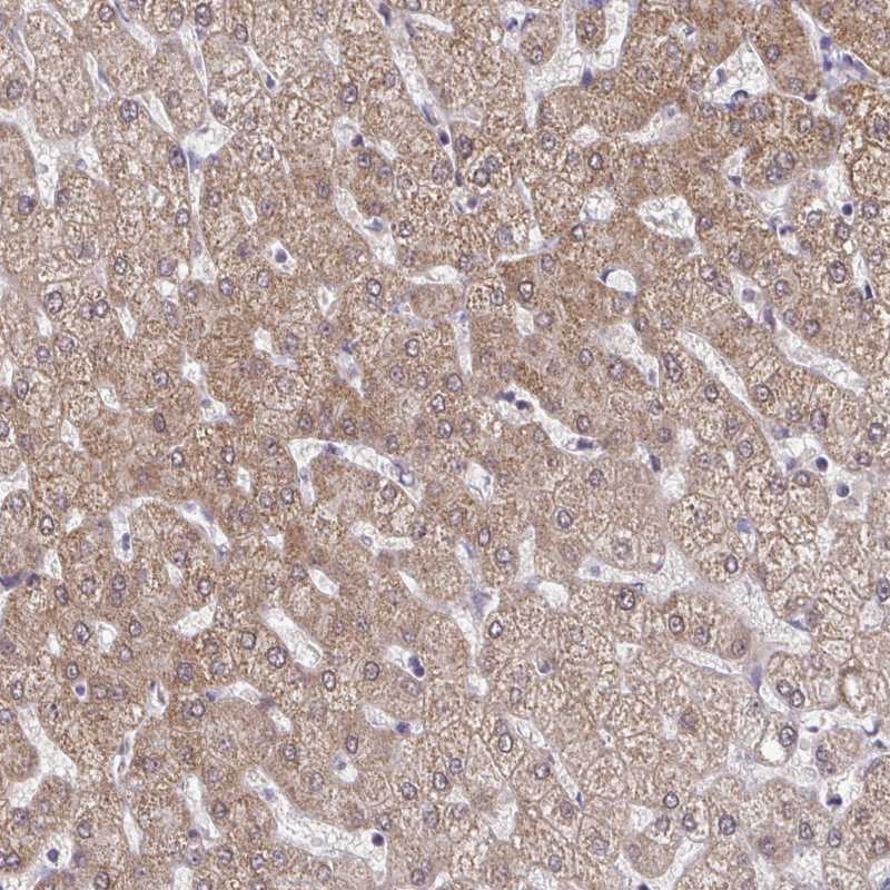 Atlas Antibodies Anti-C9orf64 Antibody