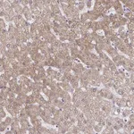 Atlas Antibodies Anti-C9orf64 Antibody