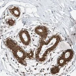 Atlas Antibodies Anti-C9orf66 Antibody