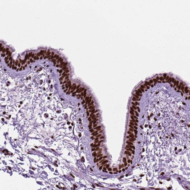Atlas Antibodies Anti-C9orf69 Antibody