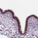 Atlas Antibodies Anti-C9orf69 Antibody