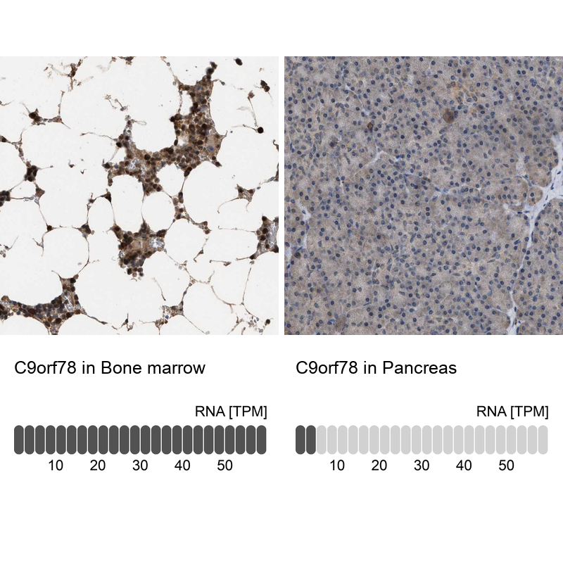 Atlas Antibodies Anti-C9orf78 Antibody
