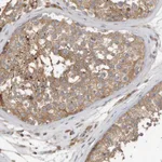 Atlas Antibodies Anti-C9orf72 Antibody