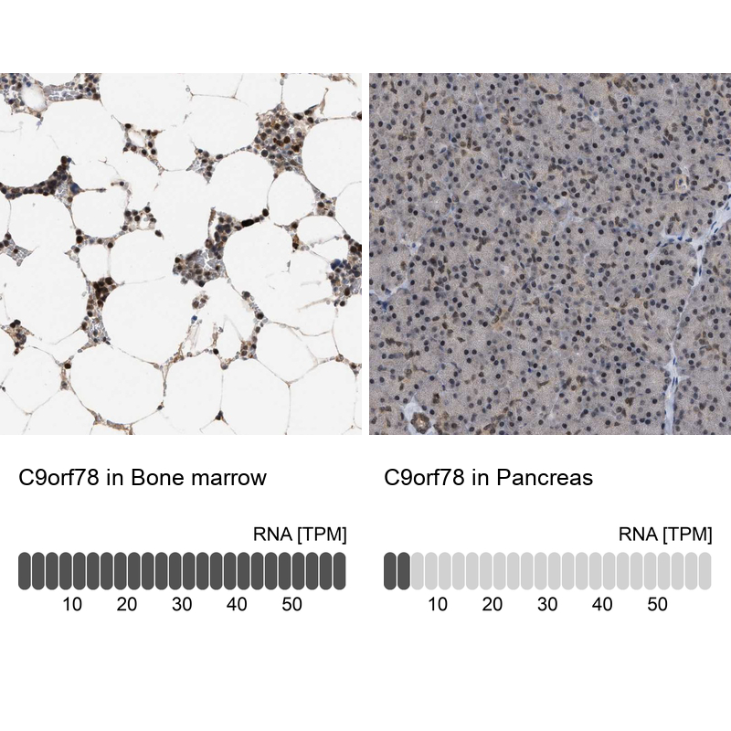 Atlas Antibodies Anti-C9orf78 Antibody