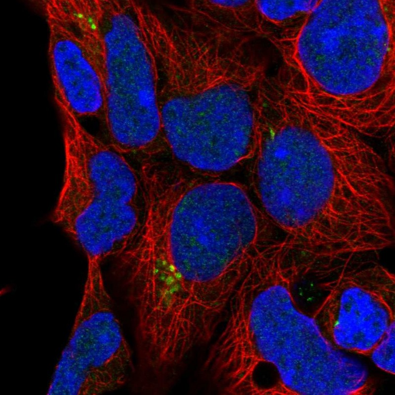 Atlas Antibodies Anti-C9orf85 Antibody