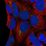 Atlas Antibodies Anti-C9orf85 Antibody