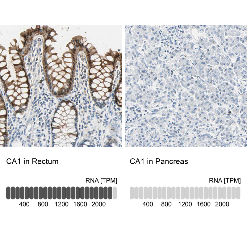 Atlas Antibodies Anti-CA1 Antibody