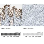 Atlas Antibodies Anti-CA1 Antibody