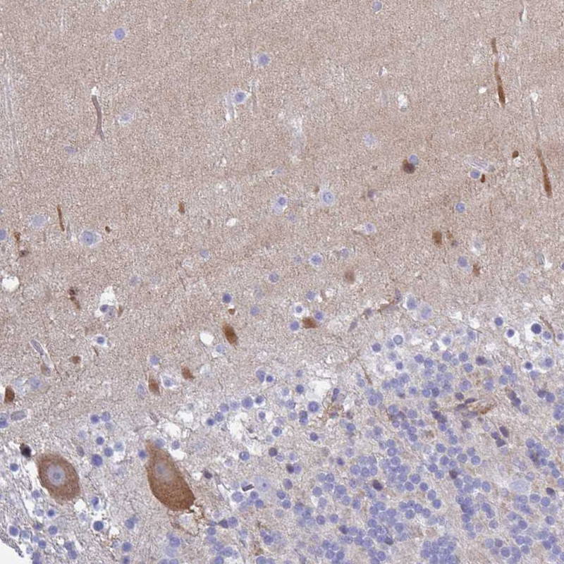 Atlas Antibodies Anti-CA10 Antibody