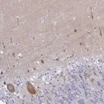 Atlas Antibodies Anti-CA10 Antibody