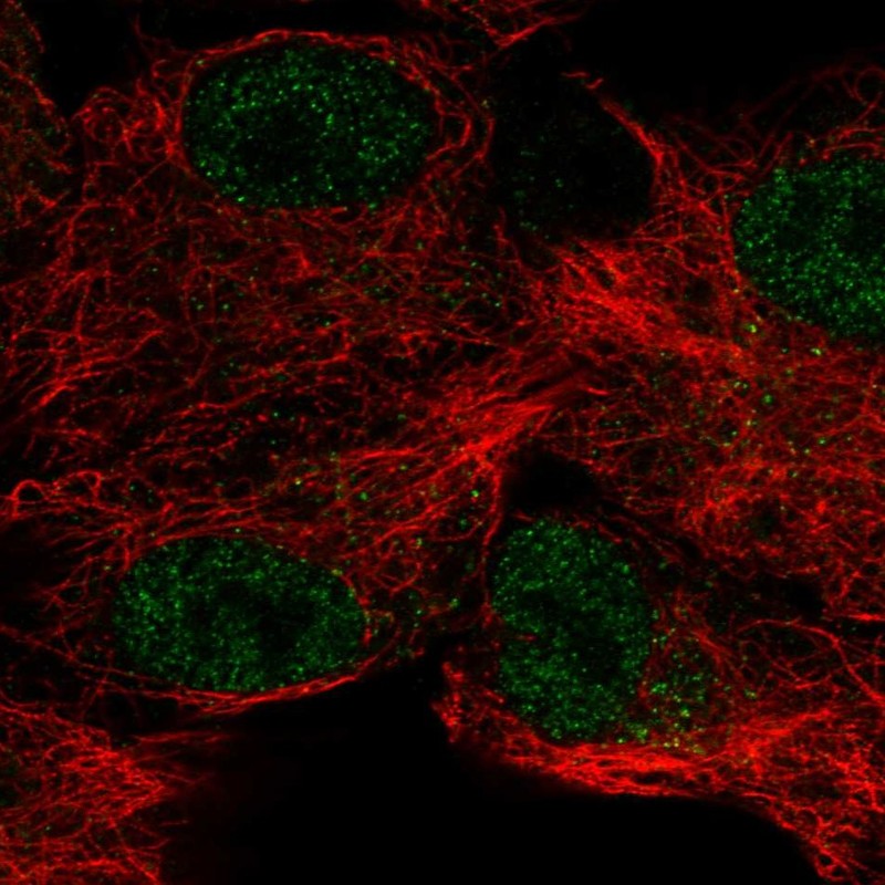Atlas Antibodies Anti-CA12 Antibody