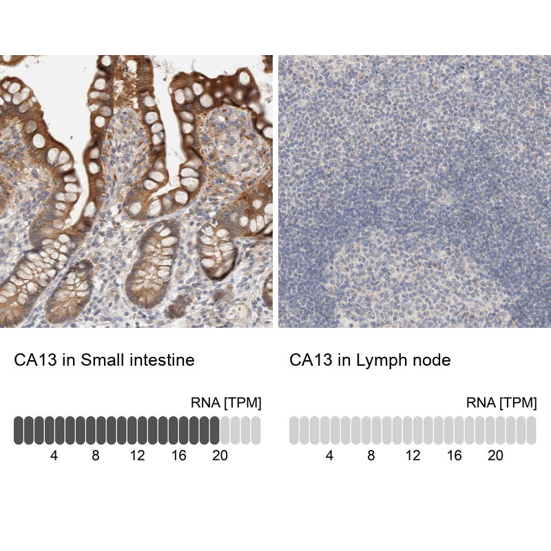 Atlas Antibodies Anti-CA13 Antibody