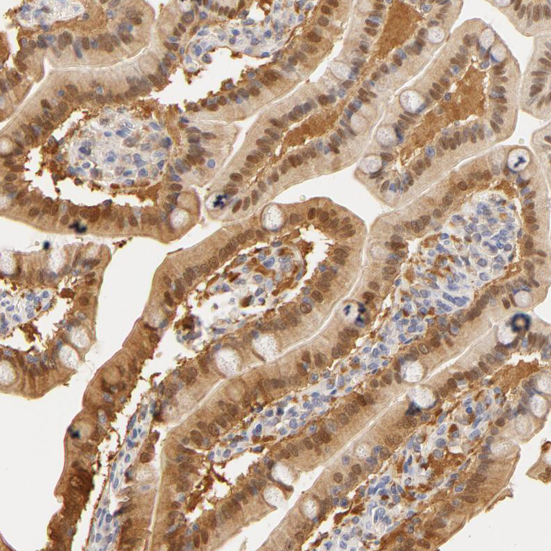 Atlas Antibodies Anti-CA2 Antibody