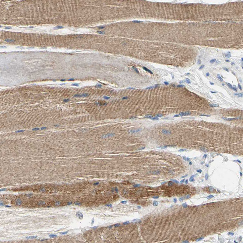 Atlas Antibodies Anti-CA14 Antibody