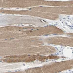 Atlas Antibodies Anti-CA14 Antibody