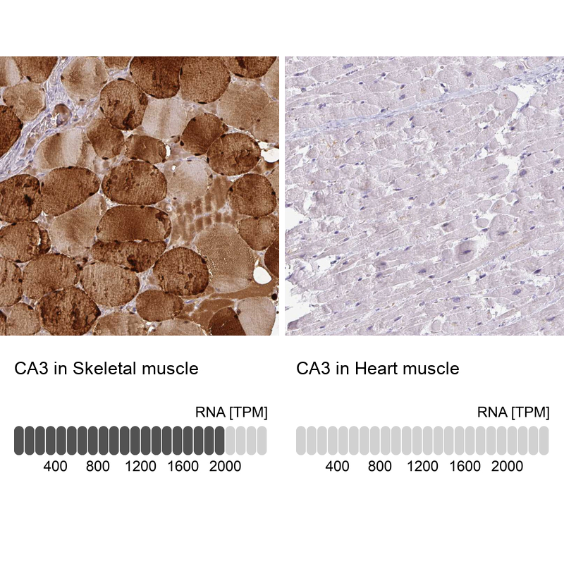 Atlas Antibodies Anti-CA3 Antibody