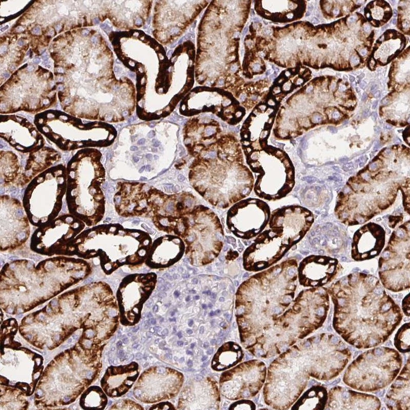 Atlas Antibodies Anti-CA12 Antibody