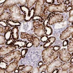 Atlas Antibodies Anti-CA12 Antibody