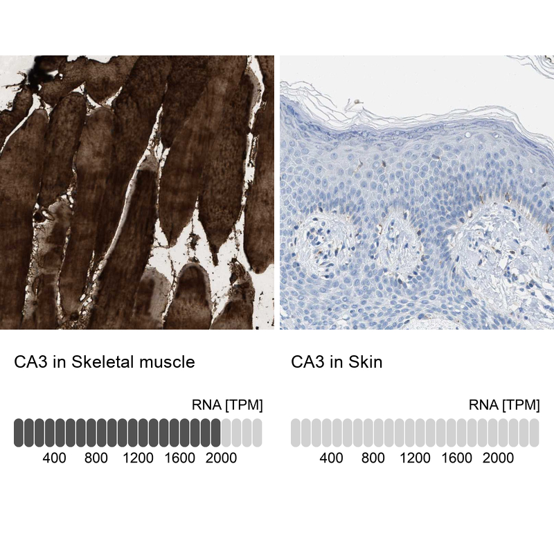 Atlas Antibodies Anti-CA3 Antibody