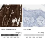 Atlas Antibodies Anti-CA3 Antibody