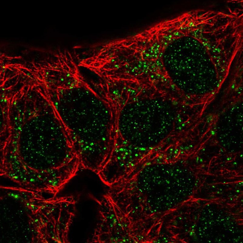 Atlas Antibodies Anti-CA10 Antibody