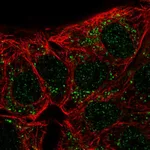 Atlas Antibodies Anti-CA10 Antibody