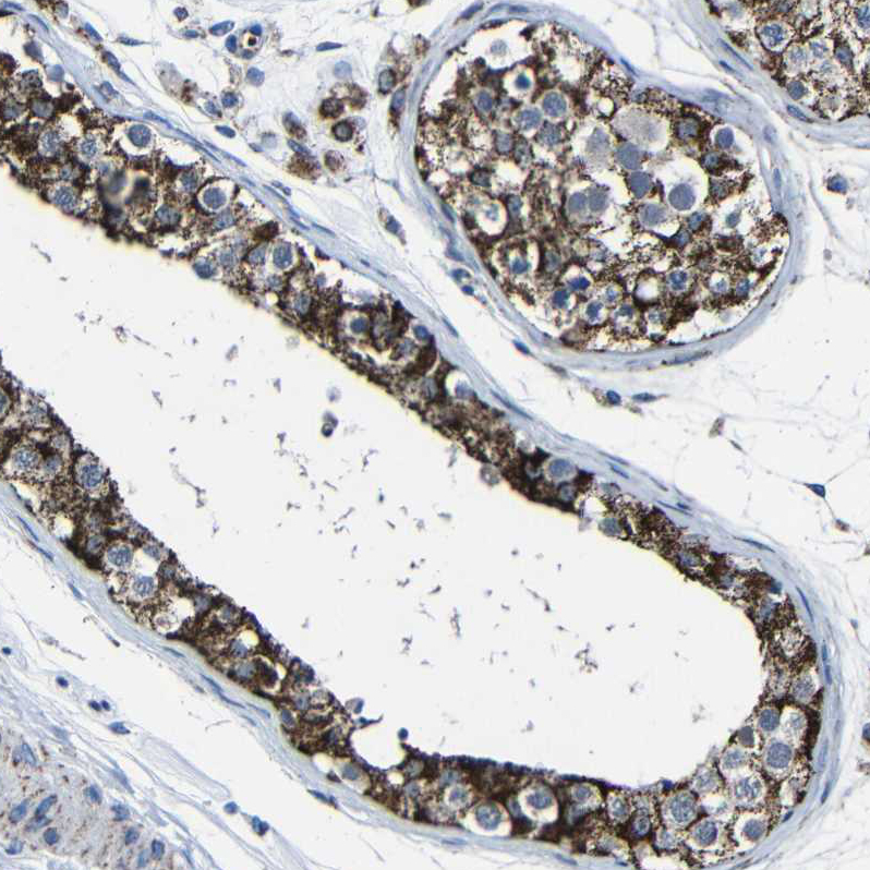 Atlas Antibodies Anti-CA5B Antibody