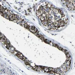 Atlas Antibodies Anti-CA5B Antibody