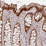 Atlas Antibodies Anti-CA7 Antibody