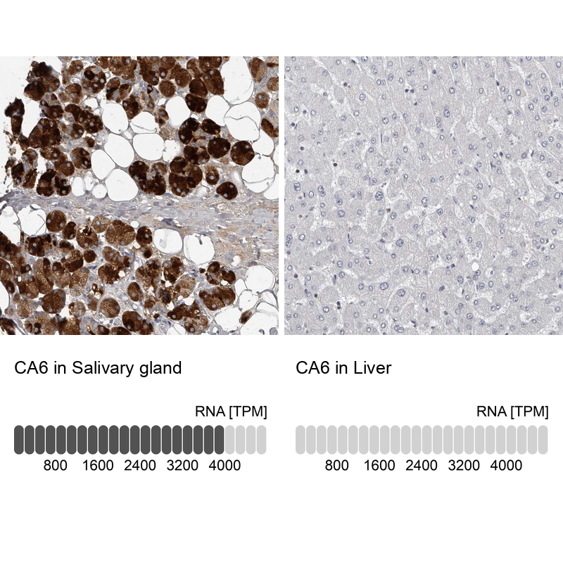 Atlas Antibodies Anti-CA6 Antibody
